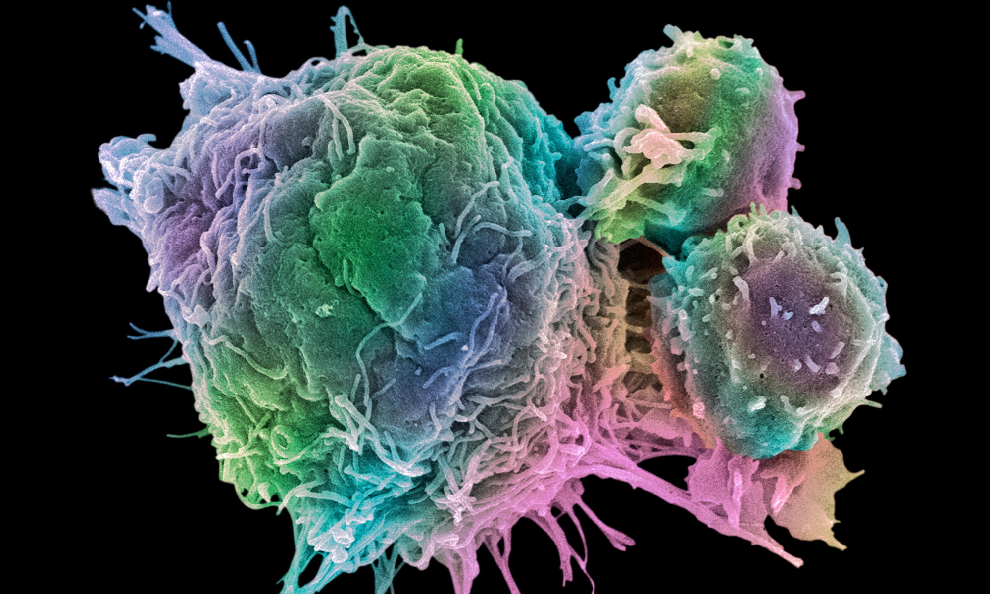 cancer cell