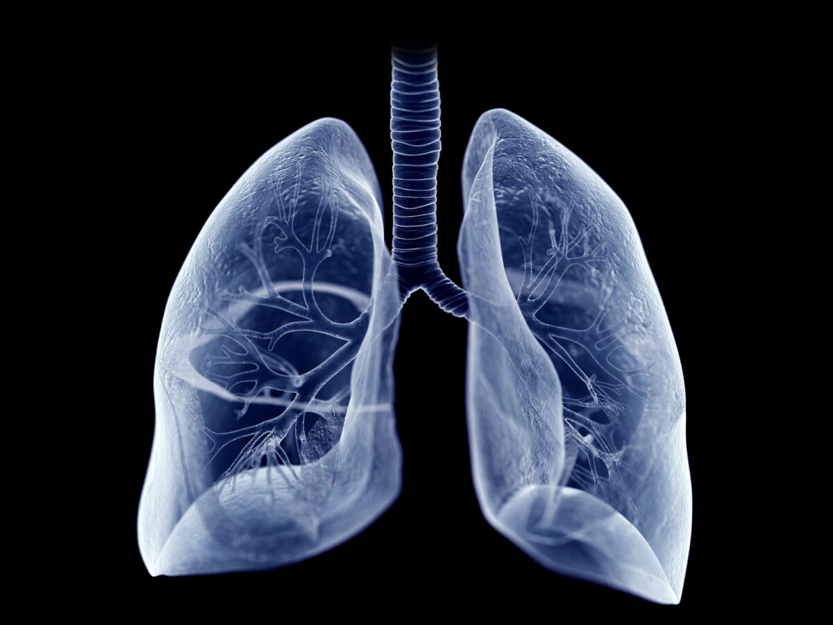 Datroway/Datverzo: Groundbreaking New Way to Treat Lung Cancer