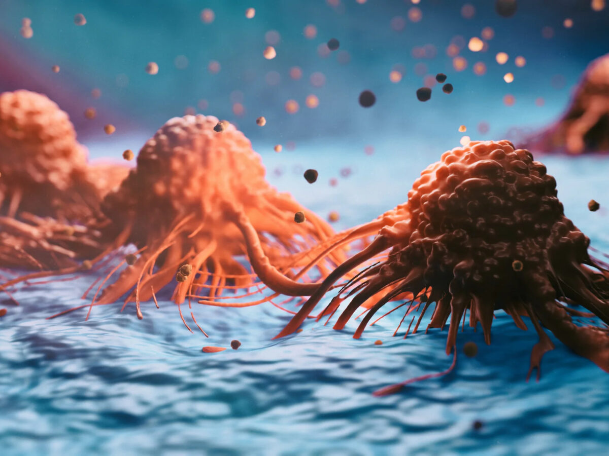 Autogene Cevumeran: Powerful mRNA Vaccine Against Pancreatic Cancer